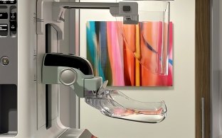 Side view of a mammogram machine